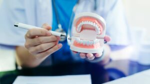 Dental Implants vs. Dentures (Benefits) Explained With Key Advantages